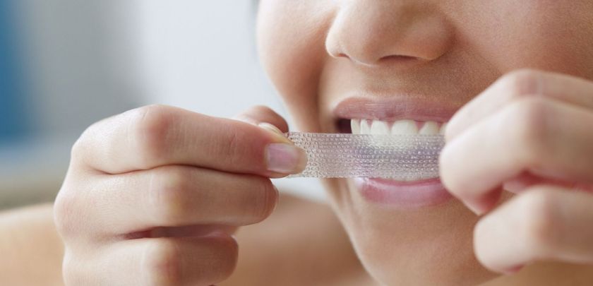 Can I Brush My Teeth Before or After Using Whitestrips