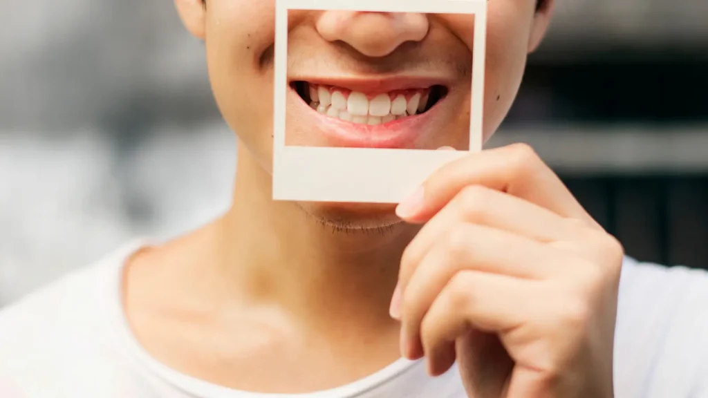 Habits For Stronger Teeth - Fluoride Your Secret Shield