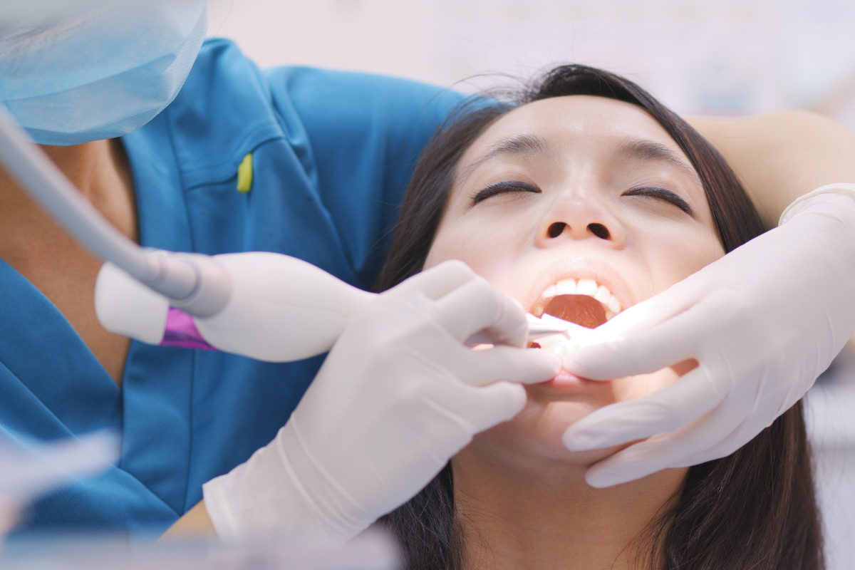 Root Canal Therapy Millbrae