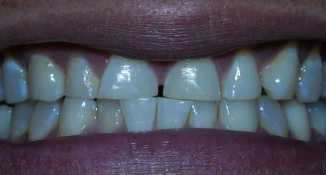 Cosmetic dentistry before treatment