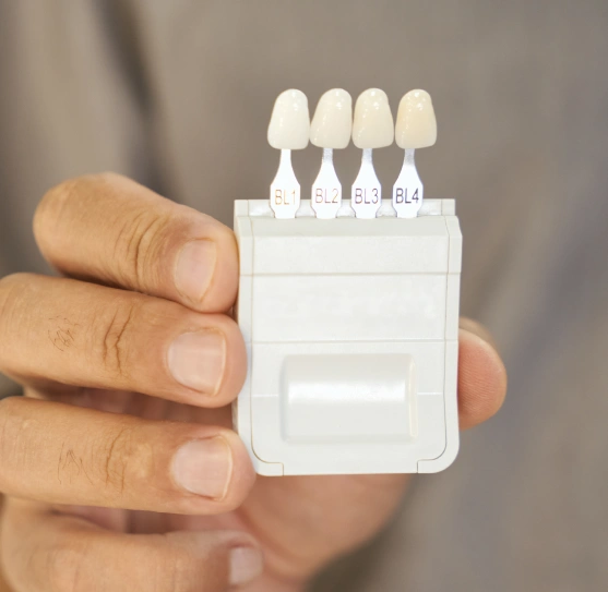Close up of a hand holding porcelain veneers