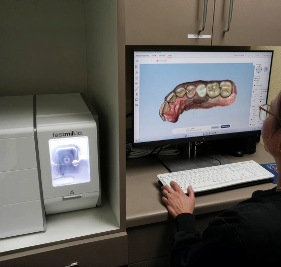 Same day dental restoration technology