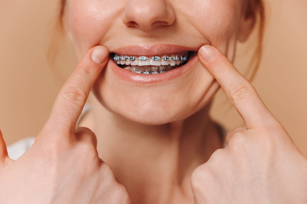 Orthodontics in Millbrae
